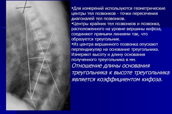Что такое кракен 2024 маркетплейс